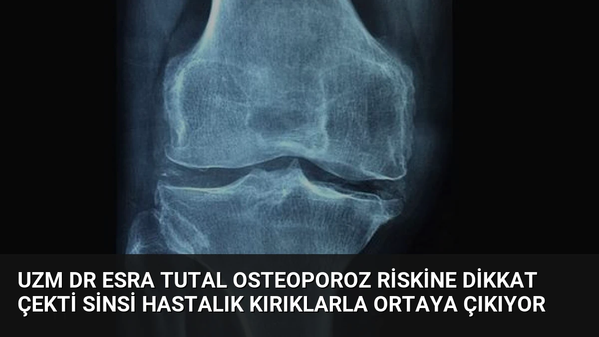 Uzm Dr Esra Tutal Osteoporoz Riskine Dikkat Çekti Sinsi Hastalık Kırıklarla Ortaya Çıkıyor