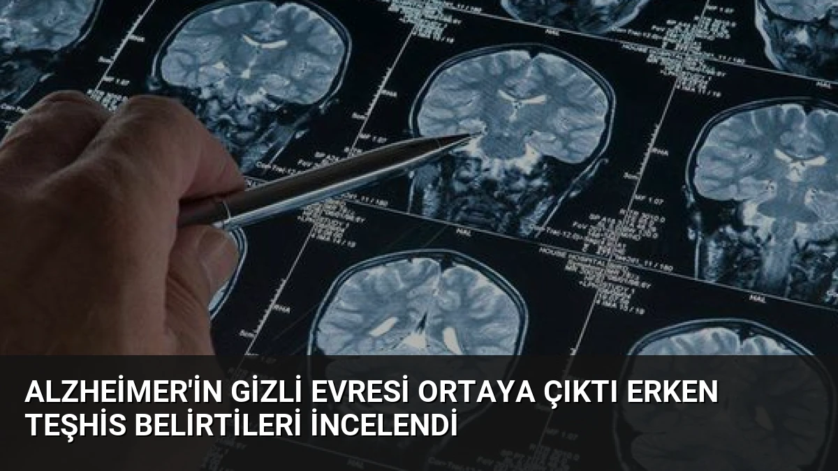 Alzheimer’in Gizli Evresi Ortaya Çıktı Erken Teşhis Belirtileri İncelendi