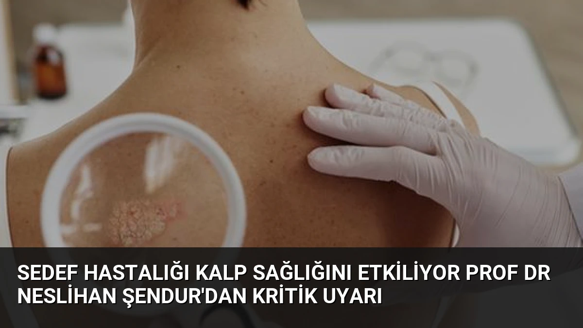 Sedef Hastalığı Kalp Sağlığını Etkiliyor Prof Dr Neslihan Şendur’dan Kritik Uyarı
