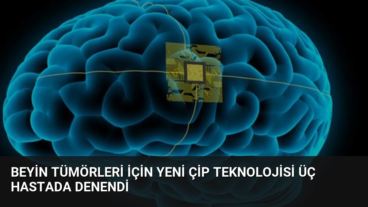 Beyin Tümörleri İçin Yeni Çip Teknolojisi Üç Hastada Denendi