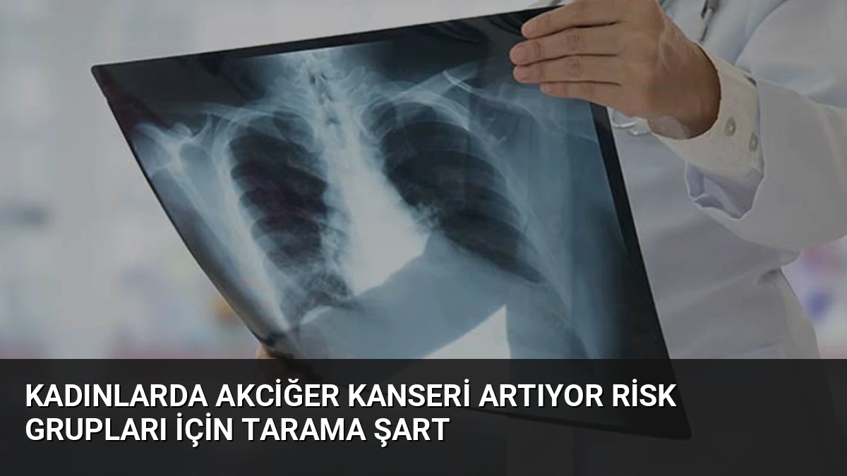 Kadınlarda Akciğer Kanseri Artıyor Risk Grupları İçin Tarama Şart
